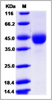SDS-PAGE analysis of Human TSPAN31 protein