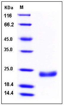 SDS-PAGE analysis of Human IL28B His tag protein