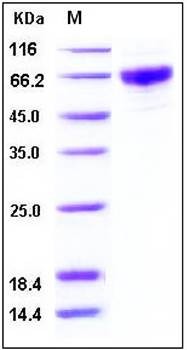 SDS-PAGE analysis of human GMCSFR His tag protein