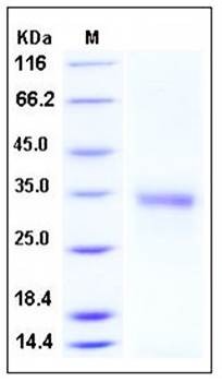 SDS-PAGE analysis of human CD74 His tag protein