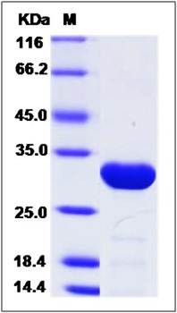 SDS-PAGE analysis of DCUN1D2 (His Tag) protein