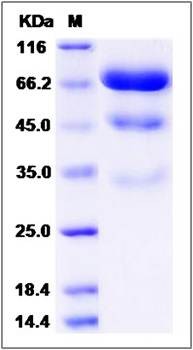 SDS-PAGE analysis of Human PLBD2 protein (His Tag)