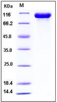 SDS-PAGE analysis of human FGFR4 Fc tag protein