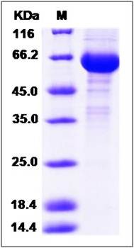 SDS-PAGE analysis of Human PPT1 protein