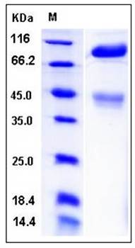 SDS-PAGE analysis of mouse c-MET His tag protein
