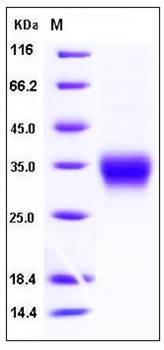 SDS-PAGE analysis of mouse CD8A His tag protein
