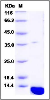 SDS-PAGE analysis of mouse S100A8 protein (His Tag)