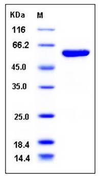 SDS-PAGE analysis of human ALDH1A3 His tag protein