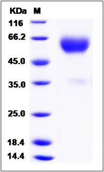 SDS-PAGE analysis of Canine TrkA protein