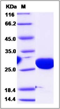 SDS-PAGE analysis of Human PMM2 protein (His Tag)