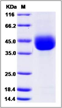 SDS-PAGE analysis of mouse ANGPTL4 protein (His Tag)