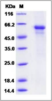 SDS-PAGE analysis of Mouse IL27 protein (His Tag)