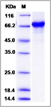 SDS-PAGE analysis of human SRFBP1 protein (GST Tag)