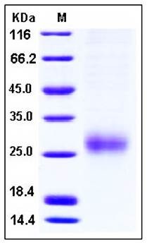 SDS-PAGE analysis of human ALK1 His tag protein