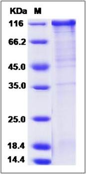 SDS-PAGE analysis of human FSTL5 protein