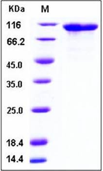 SDS-PAGE analysis of mouse FGFR4 Fc His tag protein