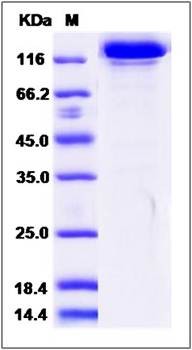 SDS-PAGE analysis of human ErbB3 protein