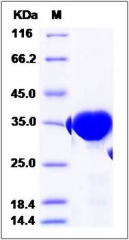 SDS-PAGE analysis of Human GPD1 protein (His Tag)