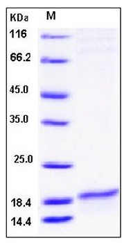 SDS-PAGE analysis of human SLPI His tag protein