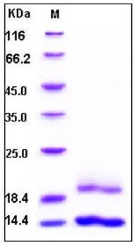 SDS-PAGE analysis of Human Cystatin E His tag protein