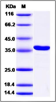 SDS-PAGE analysis of human CBR3 protein (His Tag)