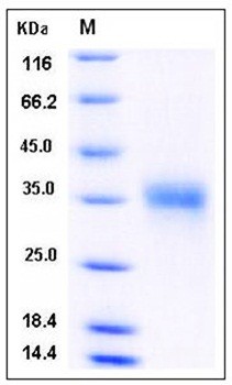 SDS-PAGE analysis of Human IGFBP6 His tag protein