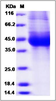 SDS-PAGE analysis of Human IL17RB protein (His Tag)