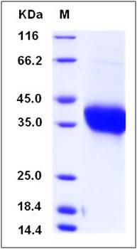 SDS-PAGE analysis of human ADM protein