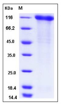 SDS-PAGE analysis of human SELP protein (His Tag)