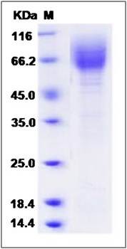 SDS-PAGE analysis of Cynomolgus LAMP2 protein (His Tag)