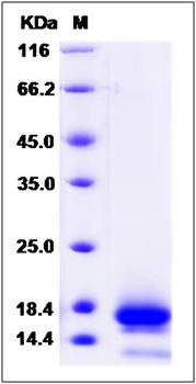 SDS-PAGE analysis of Human TSPAN8 protein (His Tag)