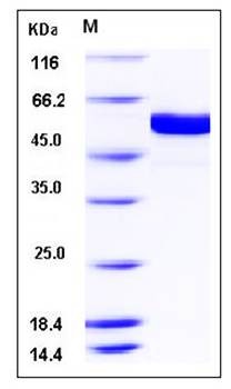 SDS-PAGE analysis of human FUT8 protein (His Tag)