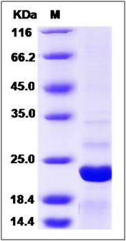 SDS-PAGE analysis of human ARF3 protein (His Tag)