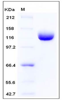 SDS-PAGE analysis of human ANPEP His tag protein