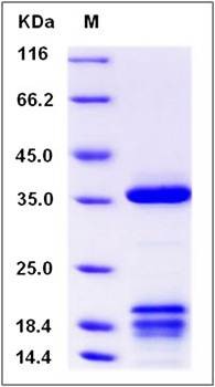 SDS-PAGE analysis of Cynomolgus IGFBP2 protein (His Tag)
