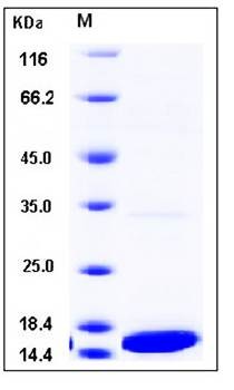 SDS-PAGE analysis of Human IL1F6 protein (Native)
