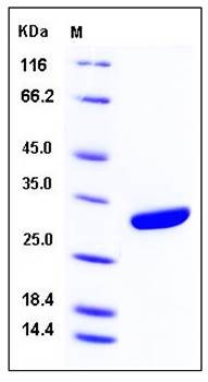 SDS-PAGE analysis of human CFD His tag protein
