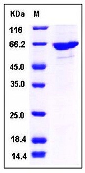 SDS-PAGE analysis of Human PADI4 His GST tag protein