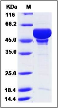 SDS-PAGE analysis of GABARAP (MBP Tag) protein