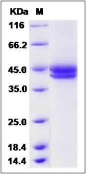 SDS-PAGE analysis of human CFHR1 protein (His Tag)