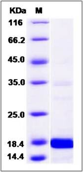 SDS-PAGE analysis of human GFER protein (His Tag)