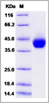 SDS-PAGE analysis of human AZGP1 protein (His Tag)