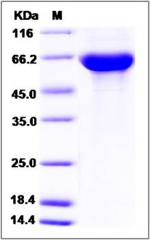 SDS-PAGE analysis of Human IGSF8 protein (His Tag)