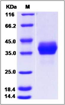 SDS-PAGE analysis of orb171646