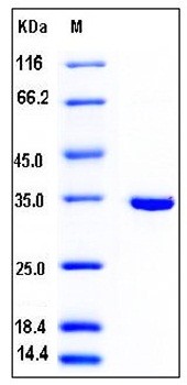 SDS-PAGE analysis of human SULT1B1 His tag protein