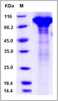 SDS-PAGE analysis of human C7 protein (His Tag)