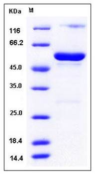 SDS-PAGE analysis of Human HNMT GST tag protein