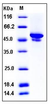 SDS-PAGE analysis of mouse CA9 His tag protein