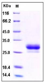 SDS-PAGE analysis of Human CD32b His tag protein