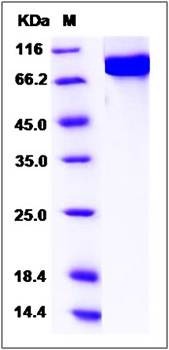 SDS-PAGE analysis of human ALOX15B protein (GST Tag)